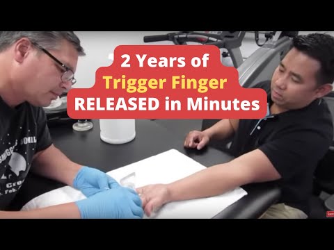 Видео: 2 года * Trigger Finger * ВЫПУЩЕНЫ за считанные минуты (РЕАЛЬНЫЕ РЕЗУЛЬТАТЫ!!)