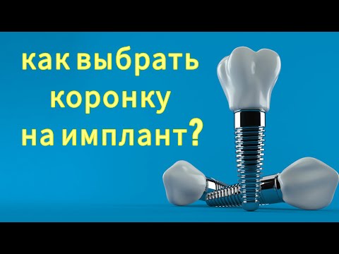 Видео: Коронка на ИМПЛАНТ. ЦИРКОНИЕВАЯ коронка на имплант. ВИНТОВАЯ фиксация на имплантах