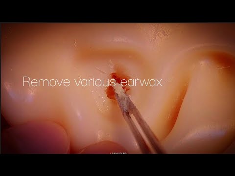 Видео: ASMR [2 часа] Различная ушная сера удаление чистка ушей!!★Visual Tingle★ *No talking*