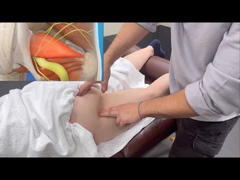 Видео: НЕ Ишиас.Седалищный нерв.Тянет ногу.Триггеры в грушевидной мышце.#триггеры #боль #седалищныйнерв