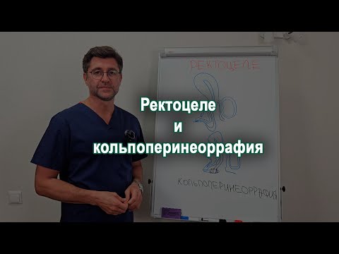 Видео: Ректоцеле и кольпоперинеоррафия. Да или Нет?