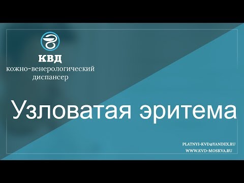 Видео: 353  Узловатая эритема