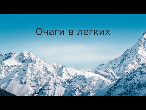 Видео: Очаги в легких