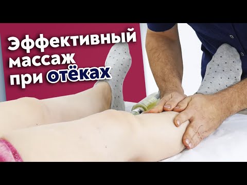Видео: Как выглядят отеки? / Почему происходит застой лимфы? / Как работать с отеками массажисту?
