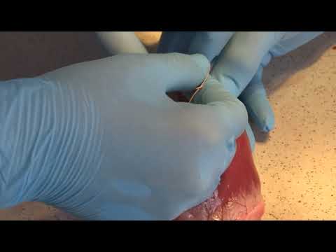 Видео: ушивание ран сердца на англ