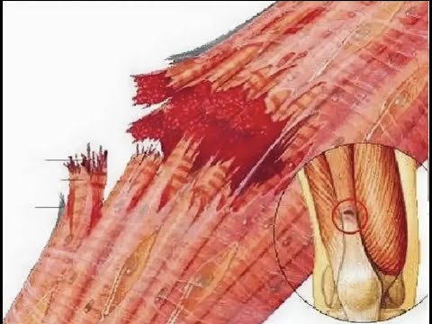 Видео: Почему без боли не будут расти мышцы.