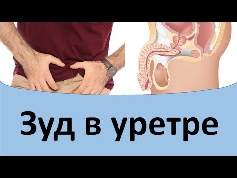 Видео: Зуд в уретре