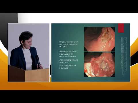 Видео: 2 Лактюнькина Е.Н. Киотская классификация в диагностике H. Pylori-ассоциированного гастрита