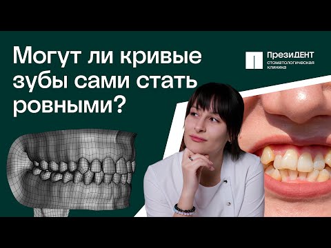 Видео: Скученность зубов: МОГУТ ли зубы выровнится сами? Нужно ли удалять лишние зубы? |ПрезиДЕНТ💚