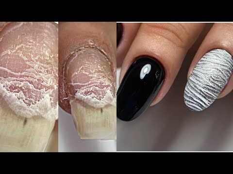 Видео: ПРОШИЛА ноготь на швейной машинке😱Деформация ногтя😱 Расслоение ногтя как исправим? Маникюр