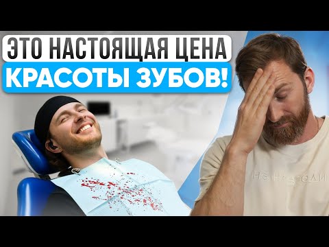 Видео: Что не так с зубами у ЕГОРА КРИДА И ДМИТРИЯ НАГИЕВА? Цена улыбки звезд в этом видео! Скорее смотри