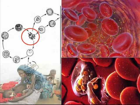 Видео: Малярийный плазмодий