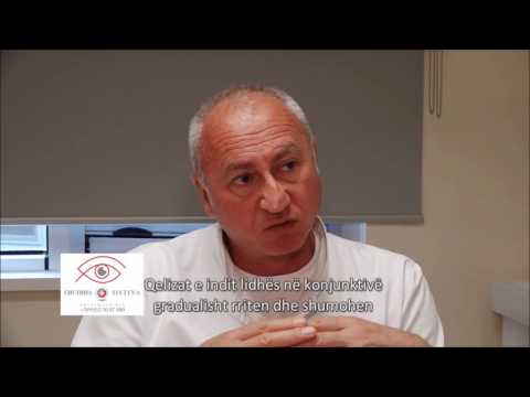 Видео: Птеригиум (надворешно перде) - Систина Офталмологија