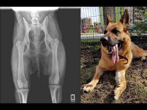 Видео: #3 Дисплазия тазобедренных суставов