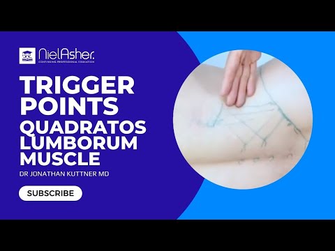 Видео: Релиз триггерной точки — квадратная мышца поясницы.