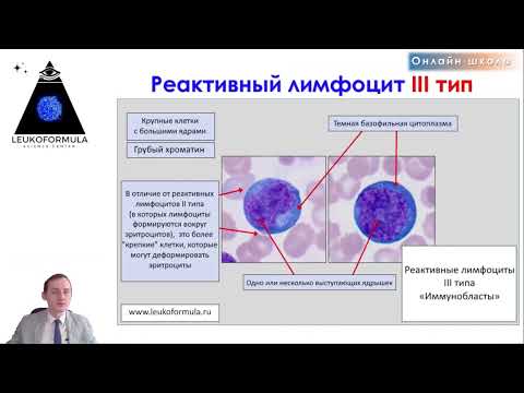 Видео: Морфология реактивных лимфоцитов (атипичных мононуклеаров). Трейлер к уроку.