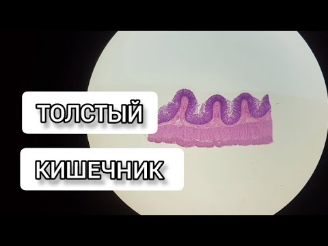 Видео: ТОЛСТЫЙ #КИШЕЧНИК