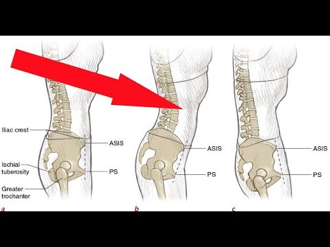 Видео: Обследование компенсации движений