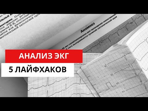 Видео: 5 особенностей (лайфхаков) при АНАЛИЗЕ ЭКГ.