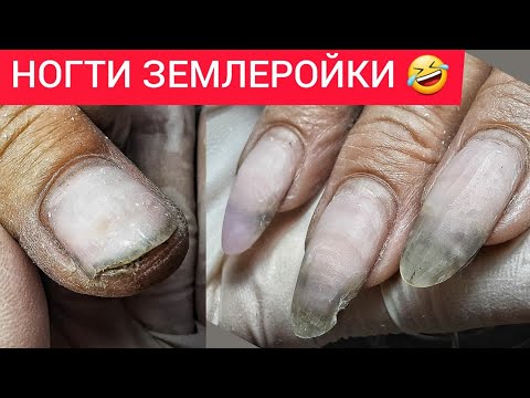 Видео: ОНИ ВЫЖИЛИ 😱НОГТИ С ОГОРОДА 💚