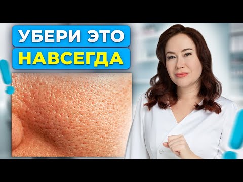 Видео: Избавься от расширенных пор! Как сузить поры без вреда для кожи?