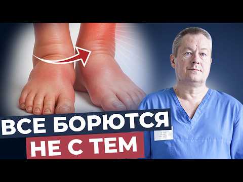 Видео: Отеки: простой метод с содой, который работает!