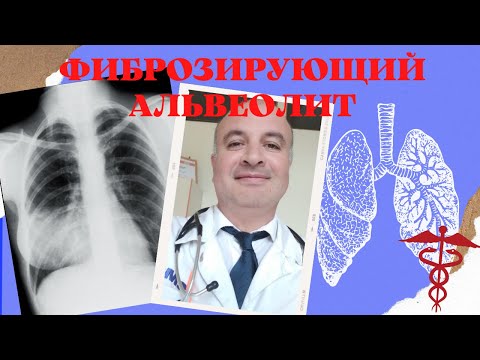 Видео: Идиопатический фиброзирующий альвеолит |  Что такое сотовое легкое?