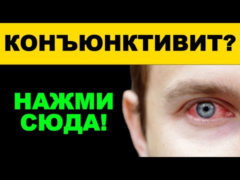 Видео: Точки при конъюнктивите | Восточные методы снятия воспаления