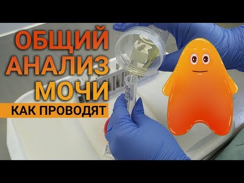 Видео: Как выполняется общий анализ мочи в лаборатории.