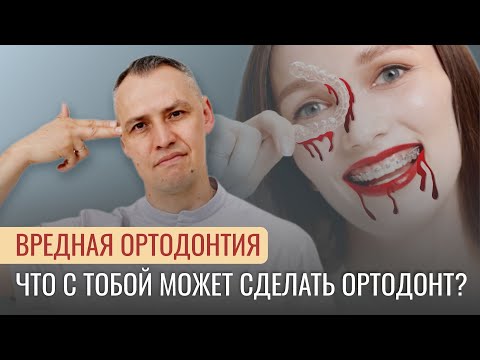Видео: ВРЕДНАЯ ОРТОДОНТИЯ. Что с тобой может сделать ортодонт?