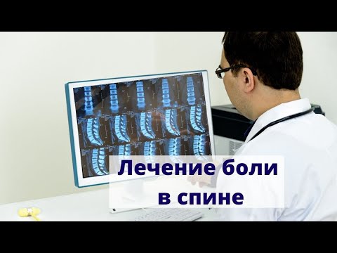 Видео: Лечение боли в спине