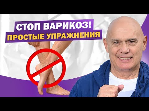 Видео: Лучшие упражнения при варикозе: как снять тяжесть и усталость в ногах