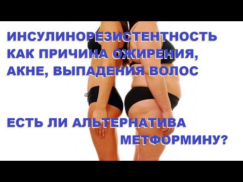 Видео: Инсулинорезистентность как причина ожирения, акне, выпадения волос. Есть ли альтернатива метформину?
