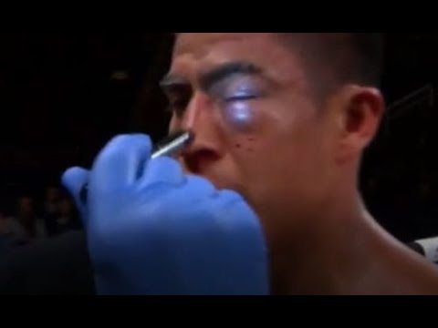 Видео: Бил, бил и прибил! Данияр Елеусинов разбил глаз и нокаутировал экс-чемпиона WBC