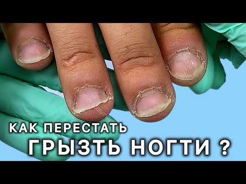 Видео: ГРЫЗЕТ и ковыряет ногти