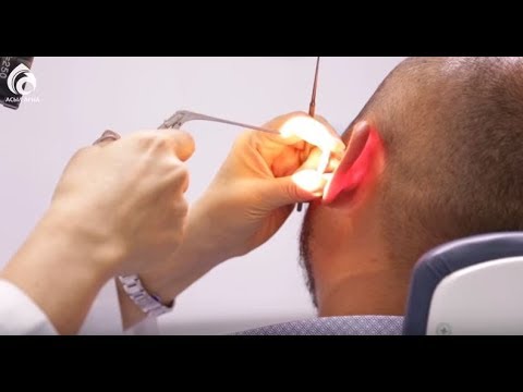 Видео: Экссудативный отит \ Семейный доктор \ Асыл арна