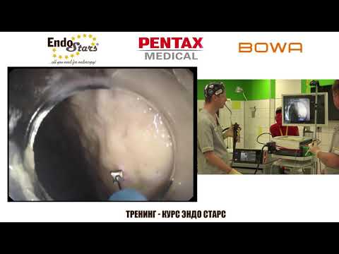 Видео: ESD. Эндо Старс (Endo Stars LLC). Онлайн-Тренинг-Курс.
