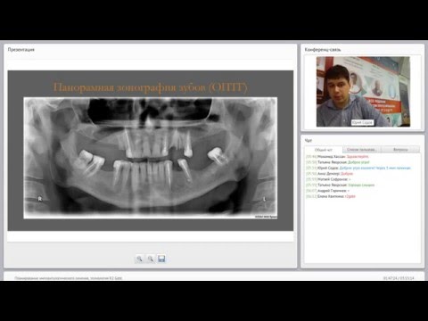 Видео: 2015 07 28 Планирование имплантологического лечения. Tехнология R2Gate.