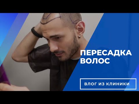 Видео: ПЕРЕСАДКА ВОЛОС МЕНЕДЖЕРА КЛИНИКИ HairHub Clinic