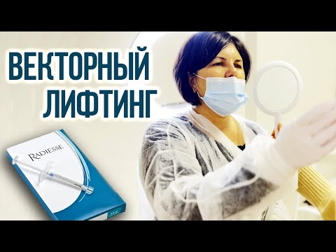 Видео: Косметологическая Процедура Подтяжки Лица | Векторный Лифтинг | Препарат Radiesse / Юлия Ивасенко