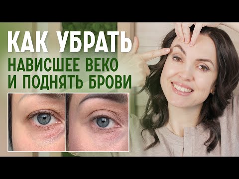 Видео: Как быстро поднять нависшее веко? Эффективный комплекс упражнений