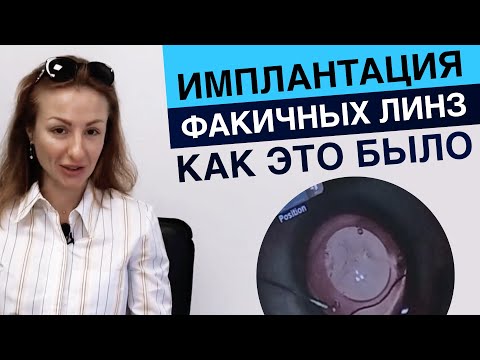 Видео: Имплантация факичных интраокулярных линз. Отзыв пациента.