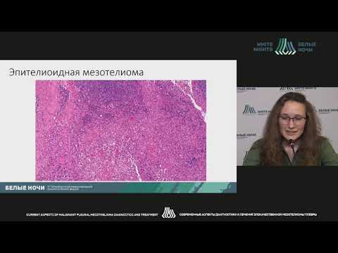 Видео: Мезотелиома плевры: патогенез и морфологическое разнообразие (Артемьева А.С.)