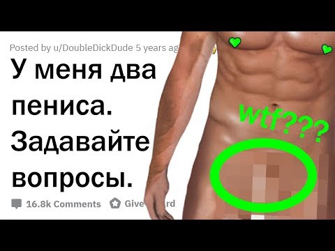 Видео: У МЕНЯ ДВА ПЕНИСА. ОТВЕЧУ НА ВОПРОСЫ!