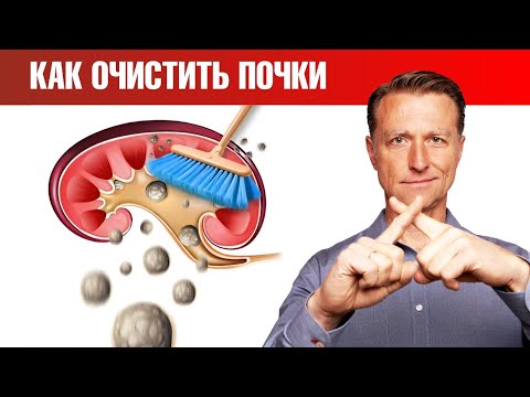 Видео: Делайте это - и камни в почках не появятся 🙌