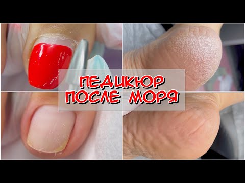 Видео: Педикюр после моря / Как делать аппаратный педикюр / Фрезы для педикюра