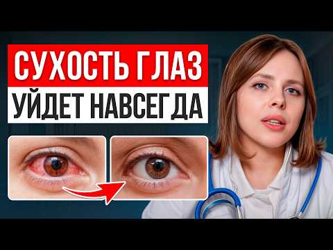 Видео: УБИРАЕМ синдром сухого глаза за 8 минут! / Простые СОВЕТЫ от врача!
