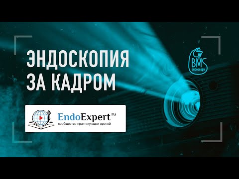 Видео: EndoExpert.ru: кто стоит за кадром, ошибки онлайн-трансляций, альфа-спикеры и  кто такой Скопыч?