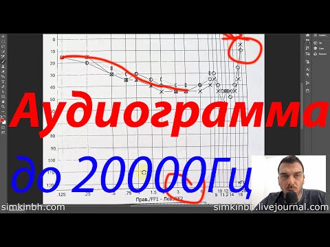 Видео: Неправильная аудиограмма до 20000Гц у врача (типичные ошибки)
