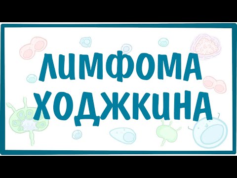 Видео: Лимфома Ходжкина (Лимфогранулематоз) — причины, симптомы, патогенез, диагностика, лечение